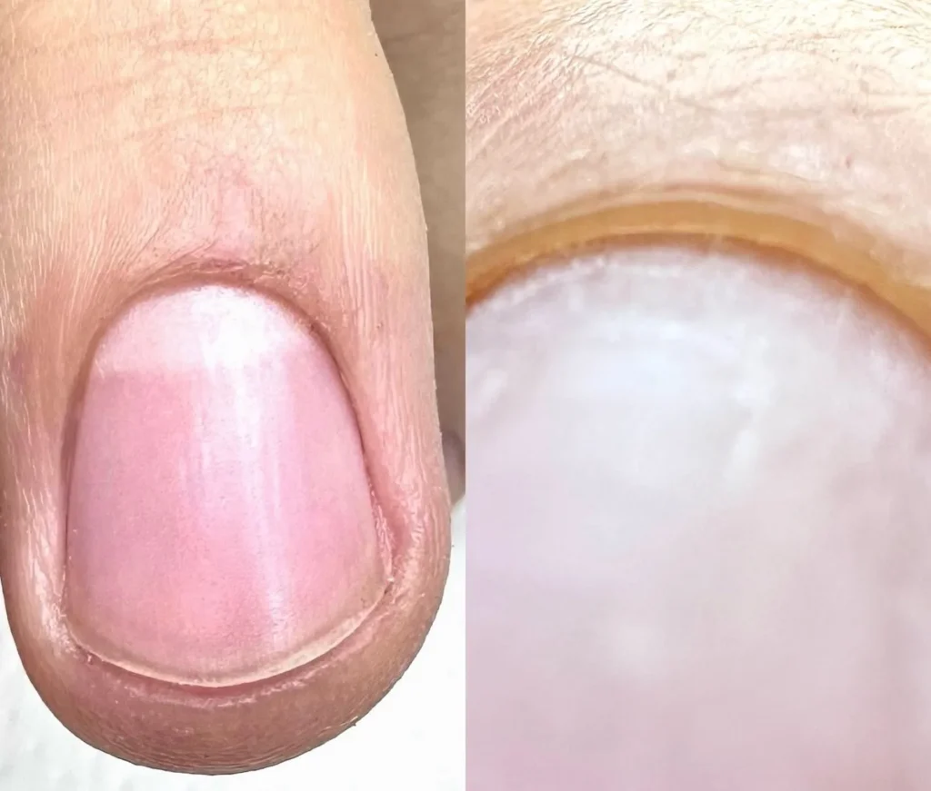 La Differenza tra la manicure e la preparazione dell'unghia naturale