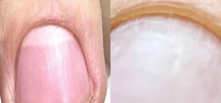 La Differenza tra la manicure e la preparazione dell'unghia naturale